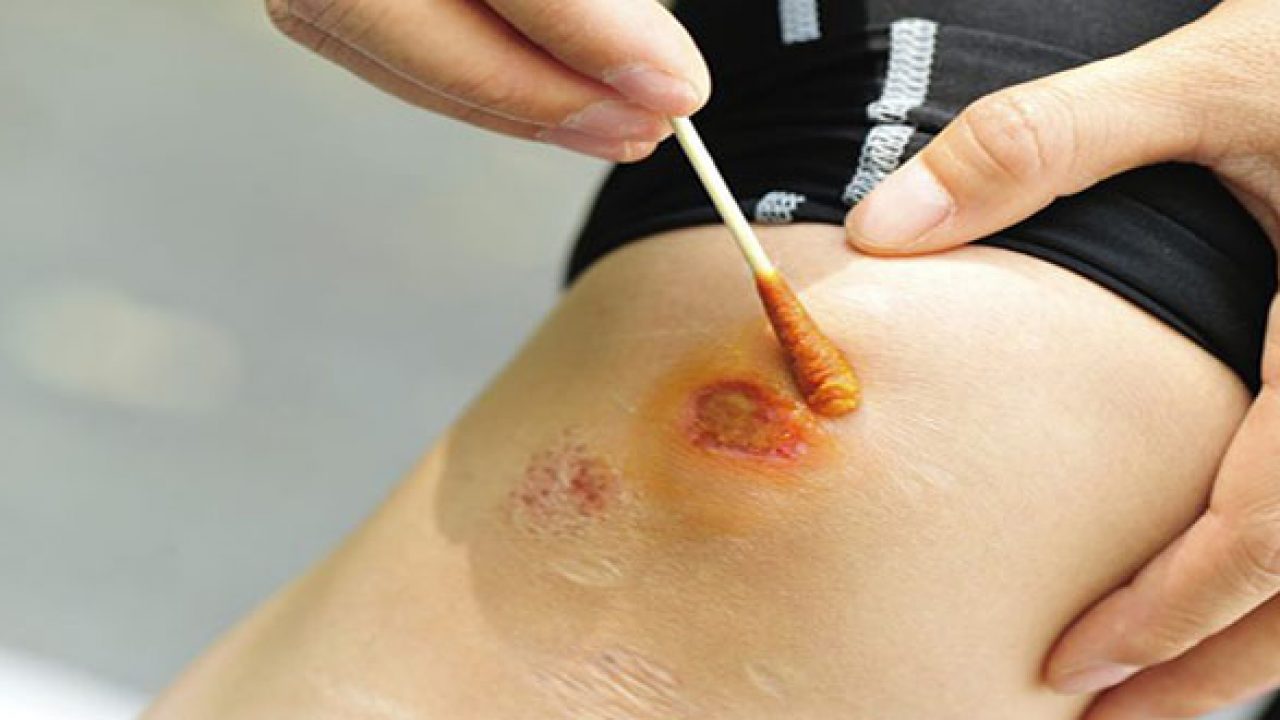 Sử dụng túi cứu thương của đơn vị cung cấp túi cứu thương loại A tại Cụm công nghiệp Phú Minh khi cần thiết.